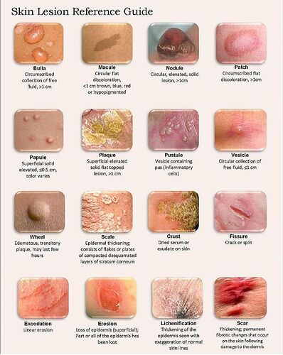Types%20of%20Skin%20lesions