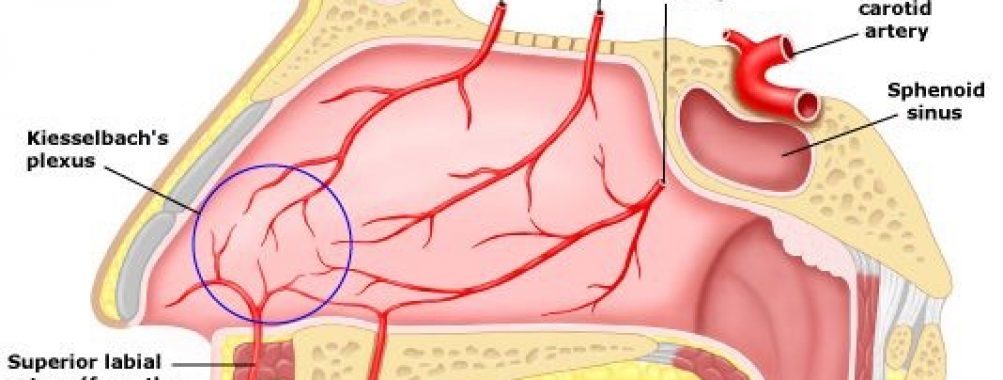 Сосуды в носу. Кровоснабжение носа зона Киссельбаха. Носовые кровотечения зона Киссельбаха. Кровеносные сосуды в носу.