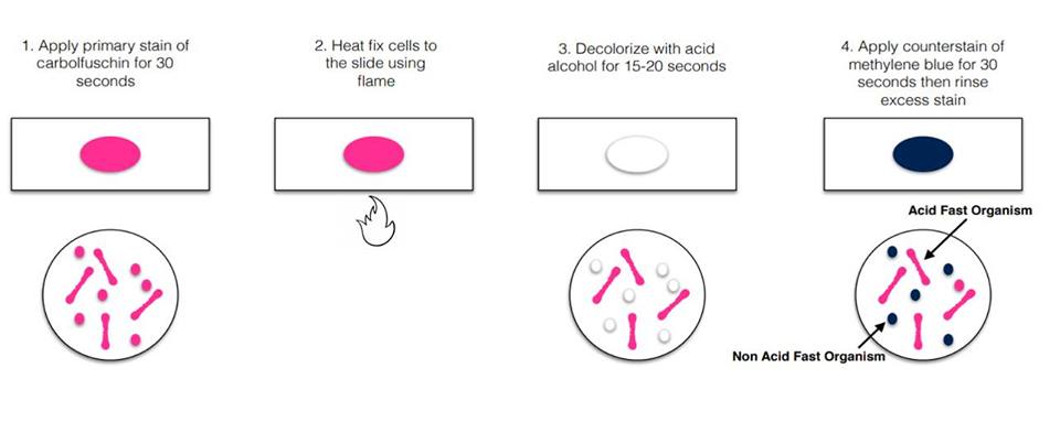 Preparation method. Acid fast Stain. Метод окраски по Ziehl-Neelsen (Цилю-Нильсену) туберкулез. Окраска по Цилю-Нильсену микробиология. Microbiology staining.