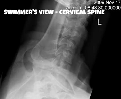 swimmers view x ray