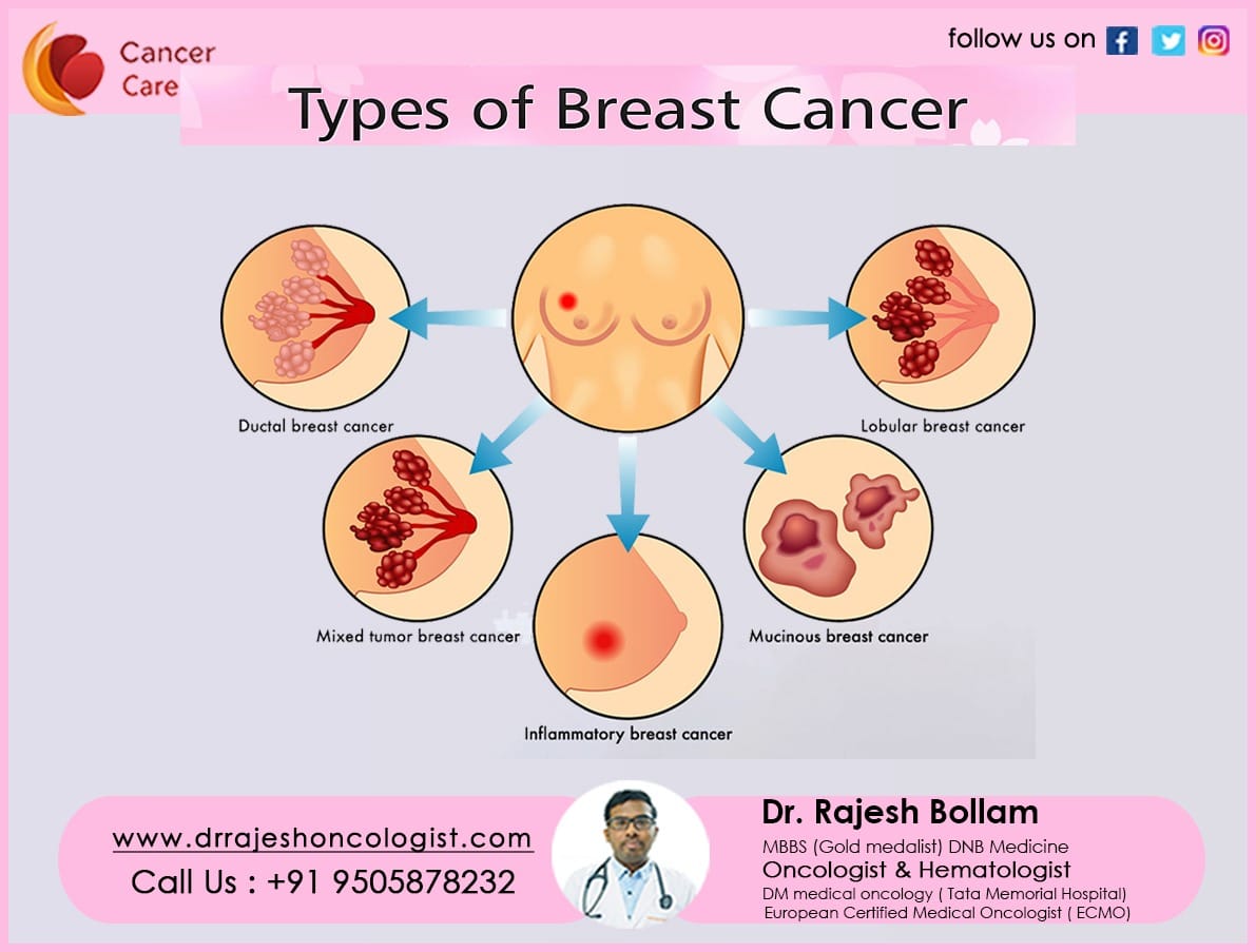 What is the another name of Breast - NEET PG -  the Best  Medical Forum for Medical Students and Doctors Worldwide